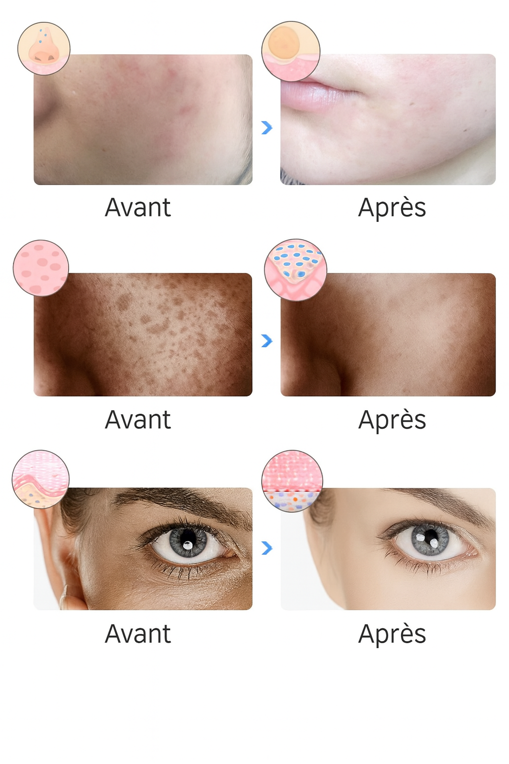 Masque Facial LED Le rituel beauté qui transforme vos soirées